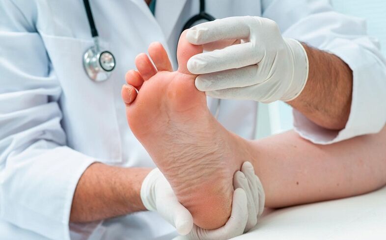 how and how to treat athlete's foot