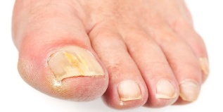 flexible toes nails