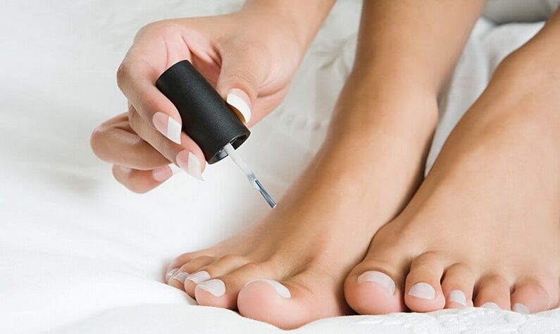 application of nail polish to treat toenail fungus