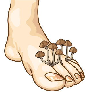 signs of fungus
